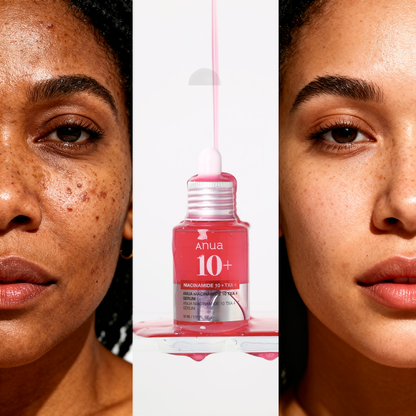Sérum à la Niacinamide 10% & TXA 4% pour Glow le Teint et Atténuer les Taches et l'Acné